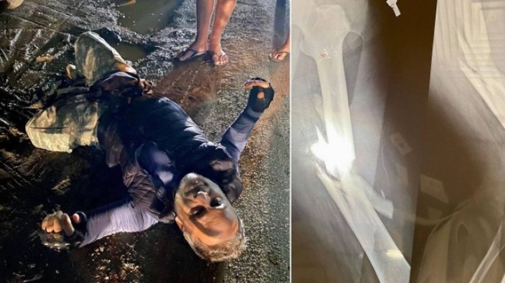 Marcos Breda sofreu grave acidente de moto em maio de 2022 — Foto: Instagram